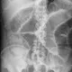Radiographie abdominale