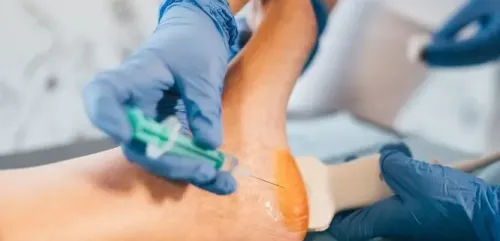 Centrifugation du sang pour obtenir le PRP