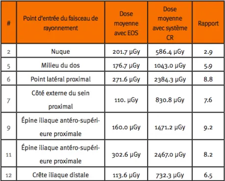 Comparaison des doses : radiographies conventionnelles vs EOS — jusqu'à 90 % de réduction de dose