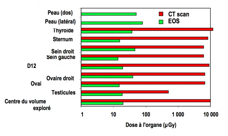 Comparaison des doses de rayonnement entre EOS et le scanner
