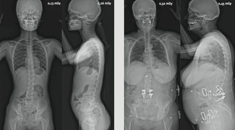 Interface EOS : analyse segmentaire du corps