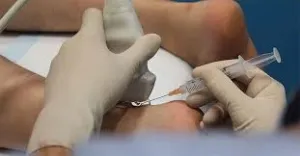 Injection de PRP au niveau du pied